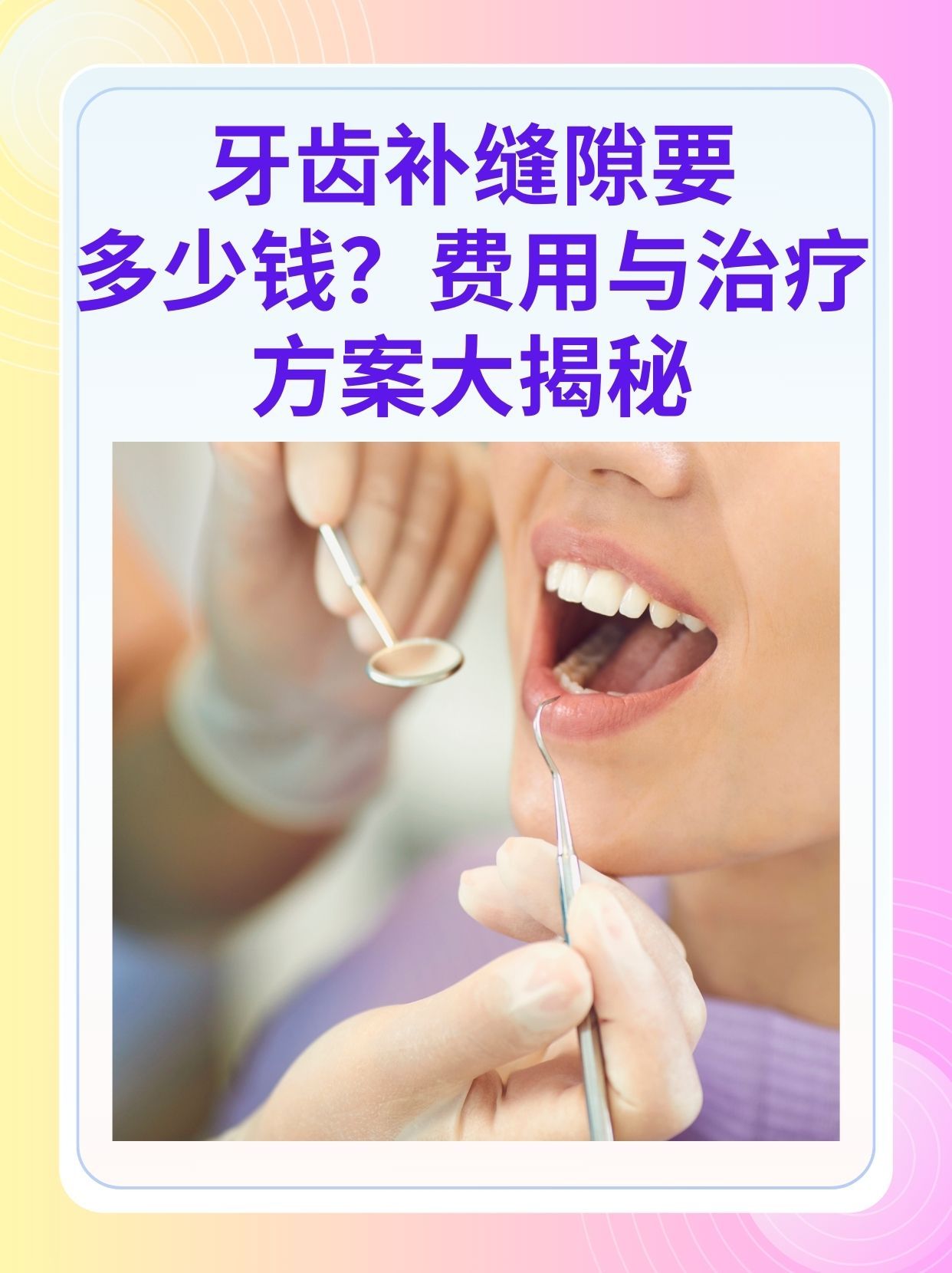 厦门补牙医保可以报销吗(补牙医保可以报销吗 哪些可以报销呢)